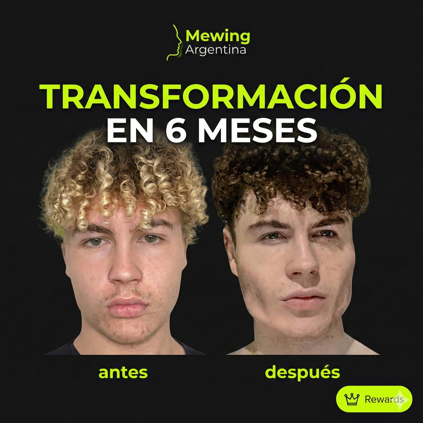 Jaw Trainer PRO, Plan 90 dias.